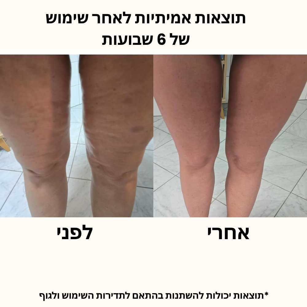 ShapeRoller - מעסה החיטוב