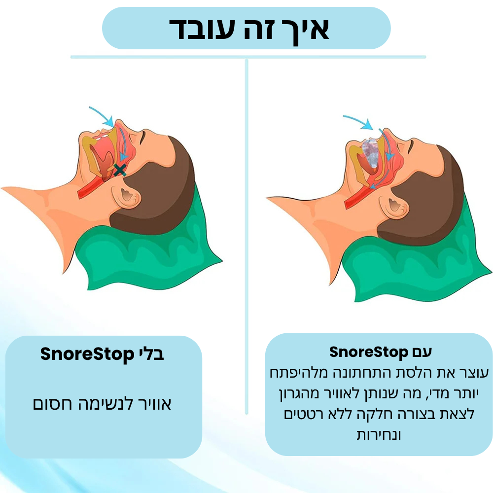 SnoreStop –מגן פה למניעת נחירות